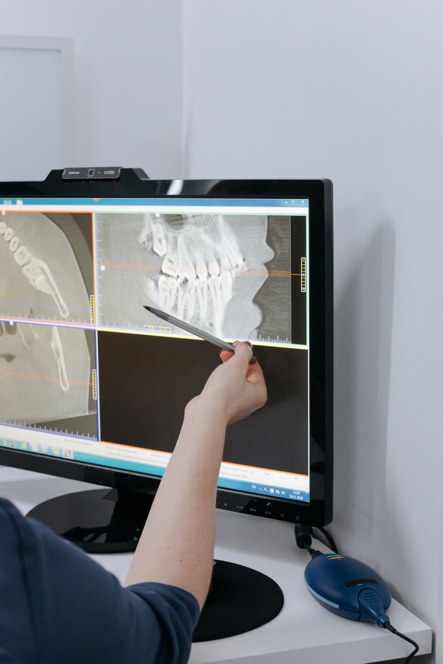 Análisis de imágenes con escáner intraoral en Clínica Dental Aurora
