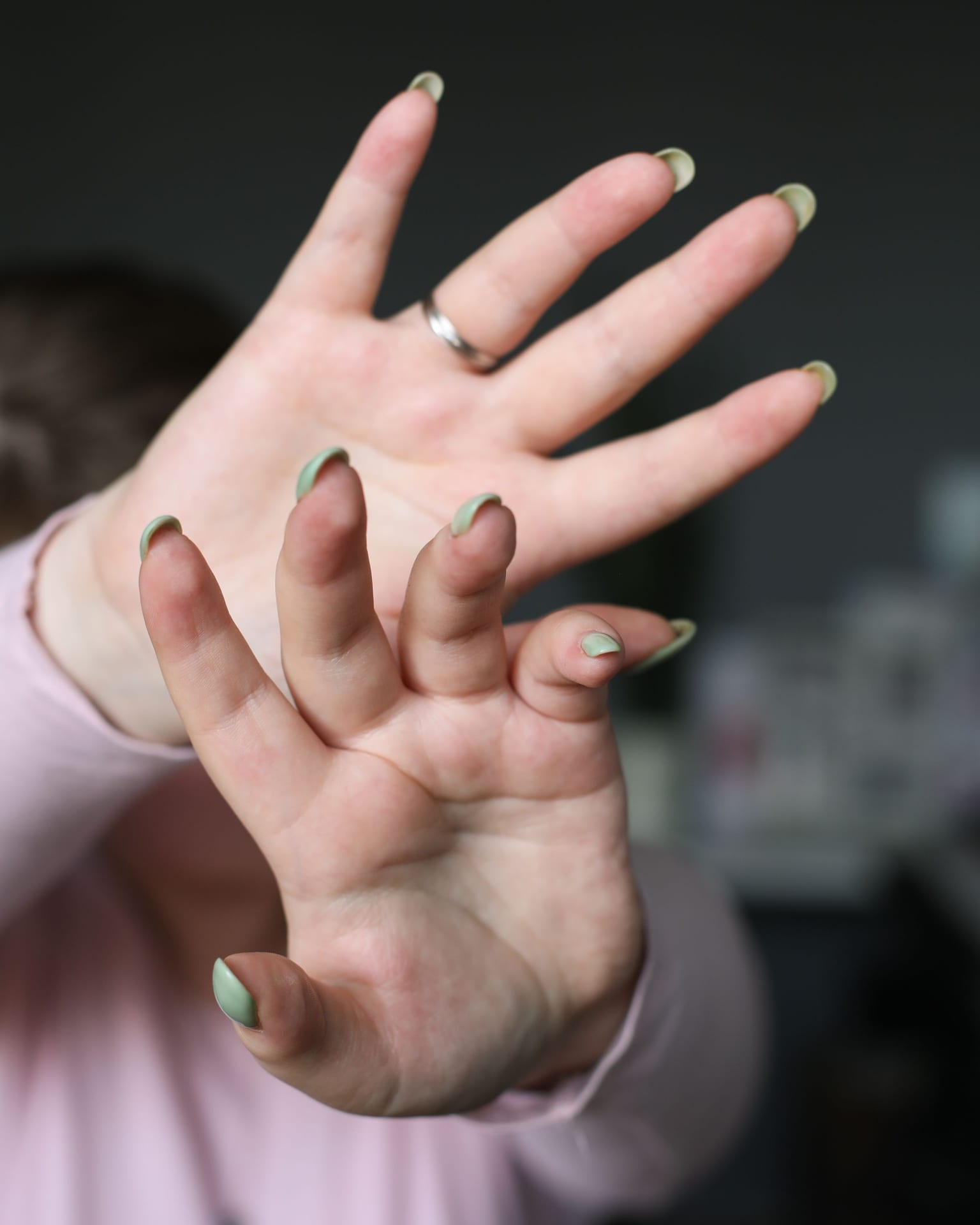 Manos antes de la manicure